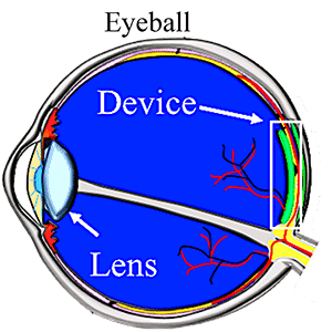 Eyeball picture
